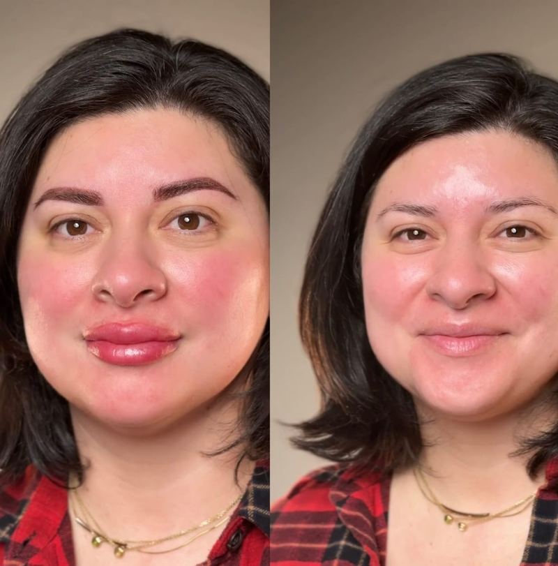Microblading before and after, Frenkel PMU House