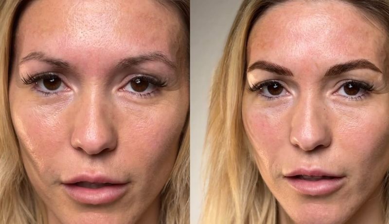 Nano Brows before and after, Frenkel PMU House
