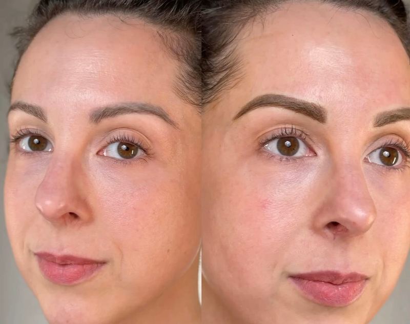 Microblading before and after, Frenkel PMU House