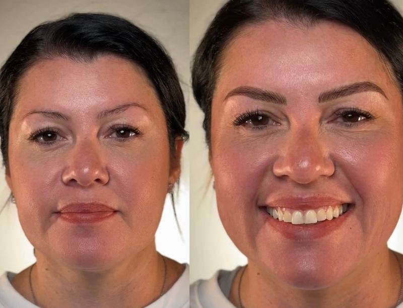Brow transformation — follow Frenkel PMU House on Instagram