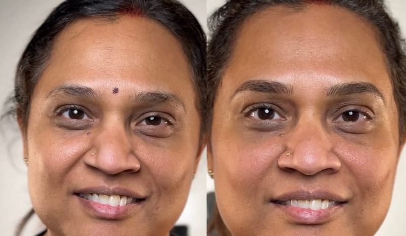 Lip blush transformation — follow Frenkel PMU House on Instagram