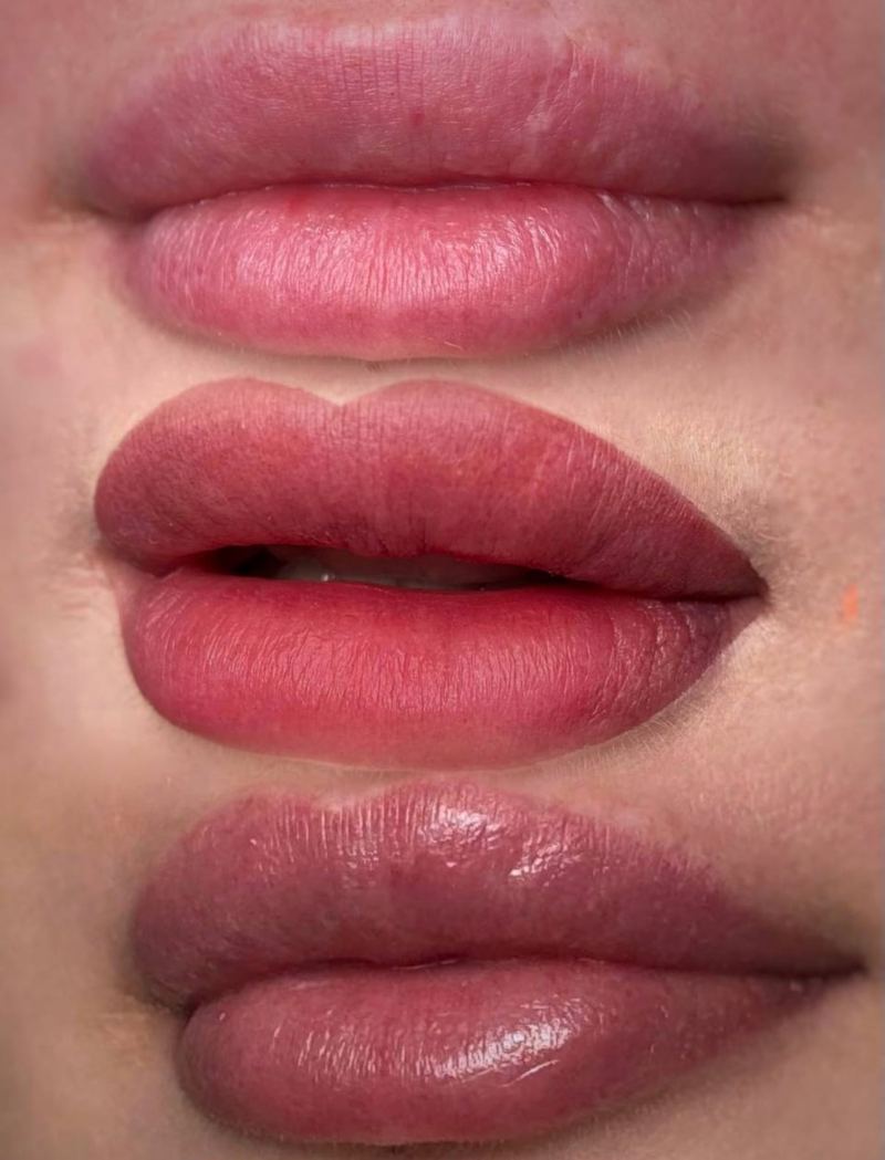 Lip Liner Enhancement before and after, Frenkel PMU House