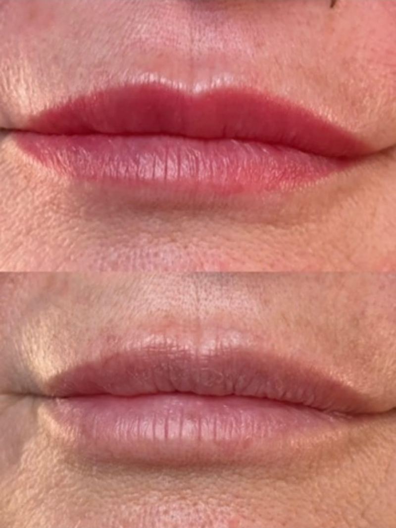 Lip Blush — Healed before and after, Frenkel PMU House